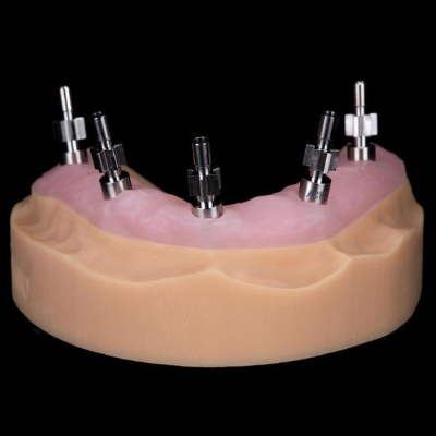 Abutments with height