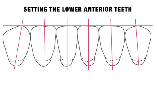 Lower analogs