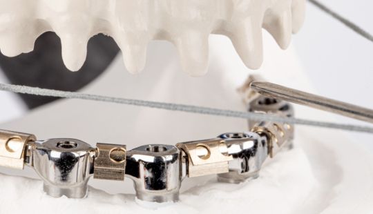 Aligned mandible