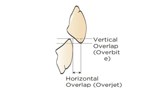 Lower analogs