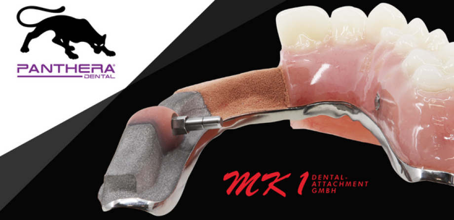 MK1 Dental-Attachment GmbH