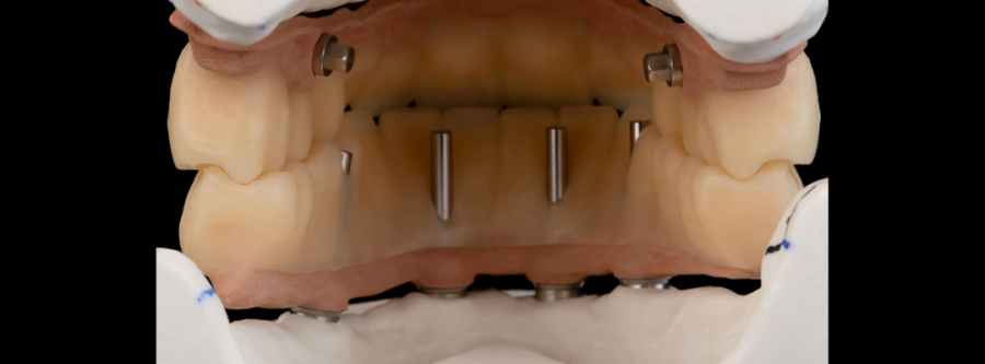 Articulator Evaluation