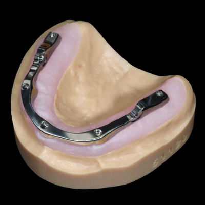 Lower abutments