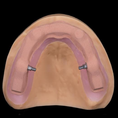 Upper Jaw Rebourke