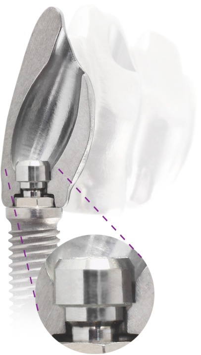 The Panthera Angulated Screw Channe