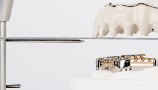 Aligned mandible