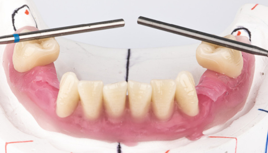 Lower analogs