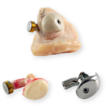 Nose_anaplastology