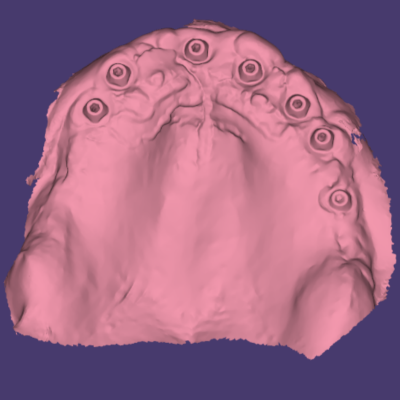 Tissue Scan