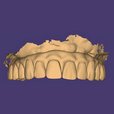 Post-Op Temp on the Model
