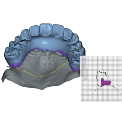 Post-Op Temp off the Model