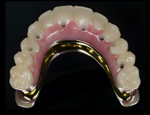 Post-Op Temp off the Model