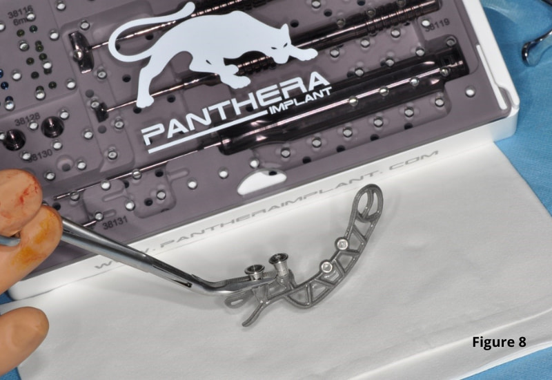 Hemostatic forceps