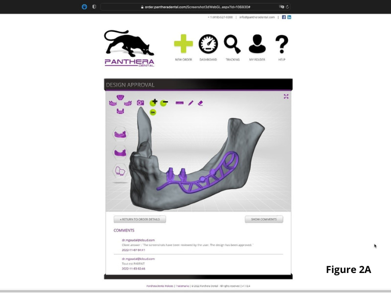 CAD/CAM