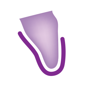 Labial Overlap