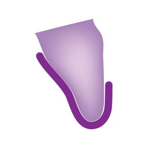 Overlap Labial with contact