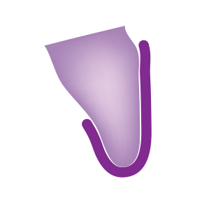 Overlap Lingual with contact
