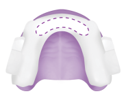 Upper Anterior