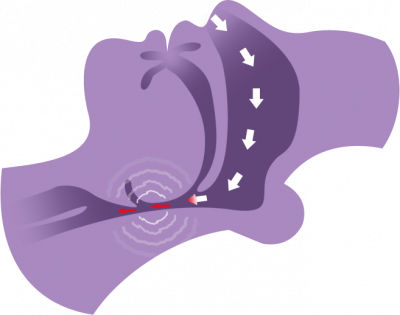 What is the difference between snoring and obstructive sleep apnea?