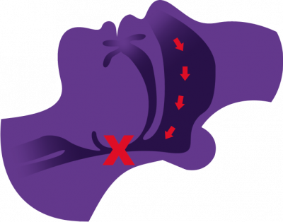 What is the difference between snoring and obstructive sleep apnea?