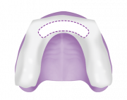 Upper Anterior